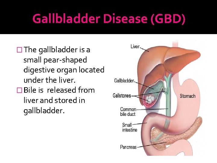 Gallbladder Disease (GBD) � The gallbladder is a small pear-shaped digestive organ located under