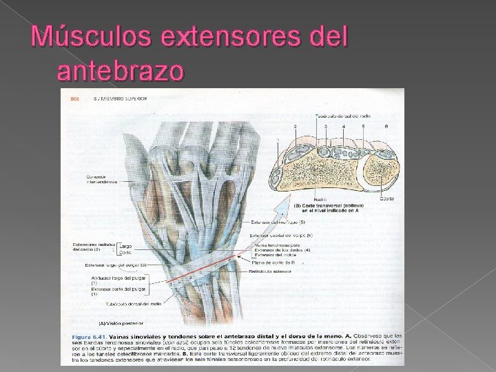 Músculos extensores del antebrazo 