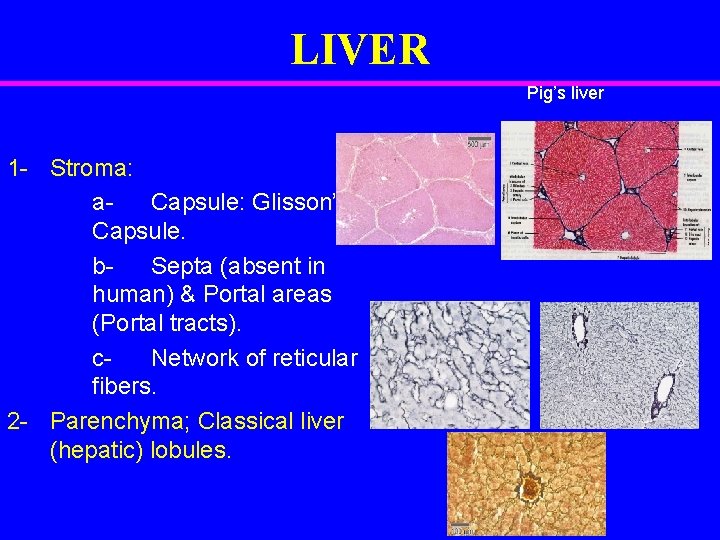 LIVER Pig’s liver 1 - Stroma: a. Capsule: Glisson’s Capsule. b. Septa (absent in