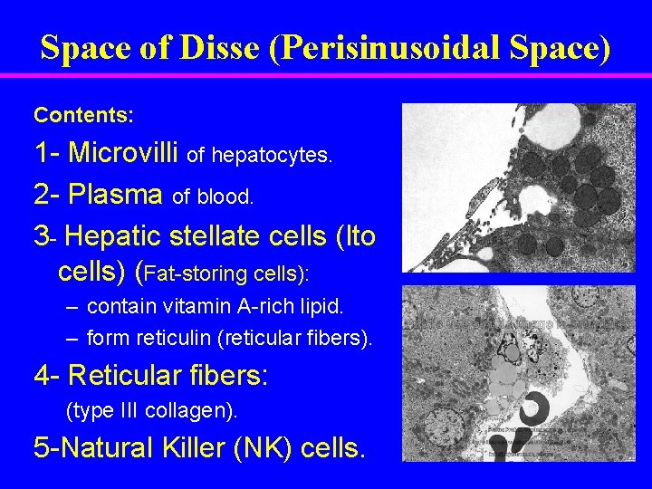 Space of Disse (Perisinusoidal Space) Contents: 1 - Microvilli of hepatocytes. 2 - Plasma