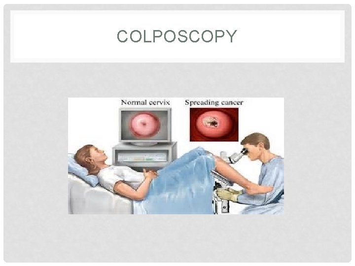 COLPOSCOPY 