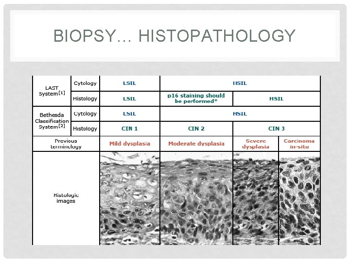 BIOPSY… HISTOPATHOLOGY 