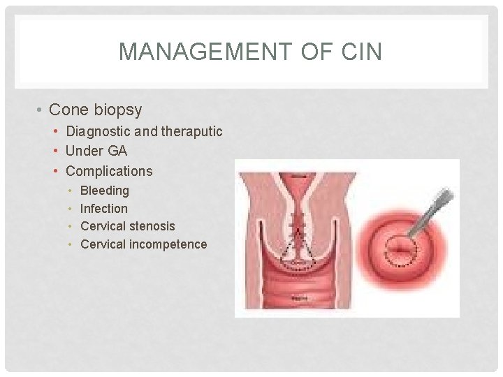 MANAGEMENT OF CIN • Cone biopsy • Diagnostic and theraputic • Under GA •