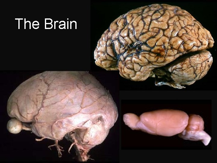 The Brain 