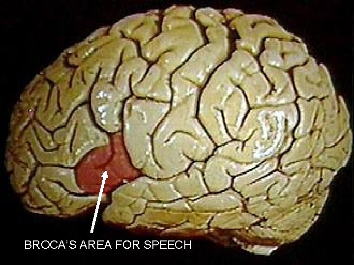 BROCA’S AREA FOR SPEECH 