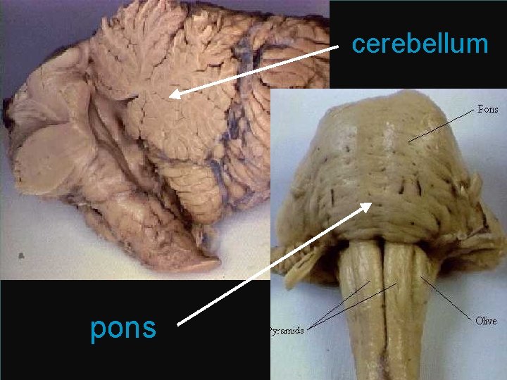 cerebellum pons 