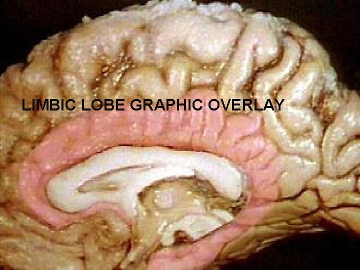LIMBIC LOBE GRAPHIC OVERLAY 