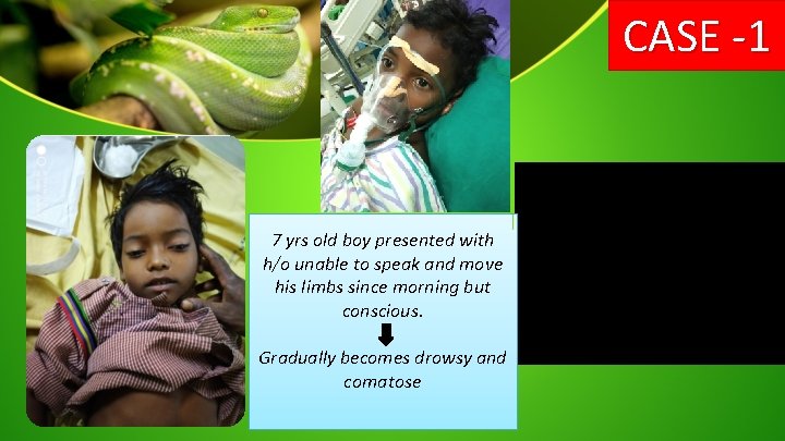 CASE -1 7 yrs old boy presented with h/o unable to speak and move