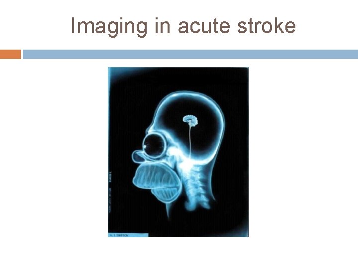 Imaging in acute stroke 