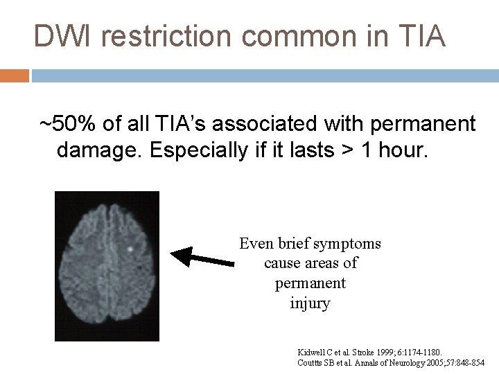 DWI restriction common in TIA ~50% of all TIA’s associated with permanent damage. Especially