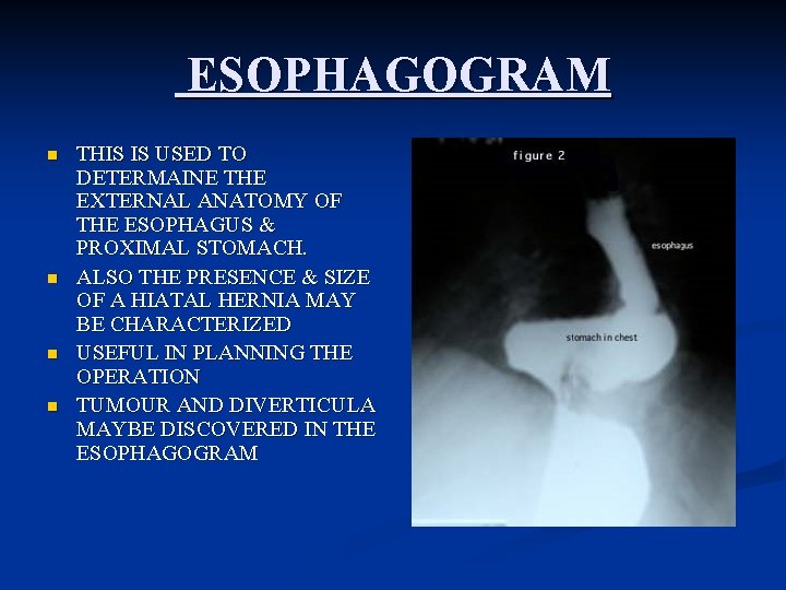 ESOPHAGOGRAM n n THIS IS USED TO DETERMAINE THE EXTERNAL ANATOMY OF THE ESOPHAGUS