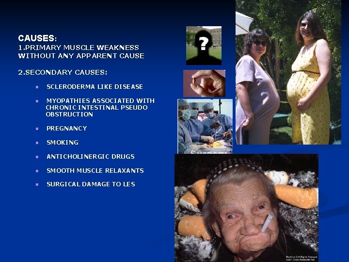 CAUSES: 1. PRIMARY MUSCLE WEAKNESS WITHOUT ANY APPARENT CAUSE 2. SECONDARY CAUSES: n SCLERODERMA