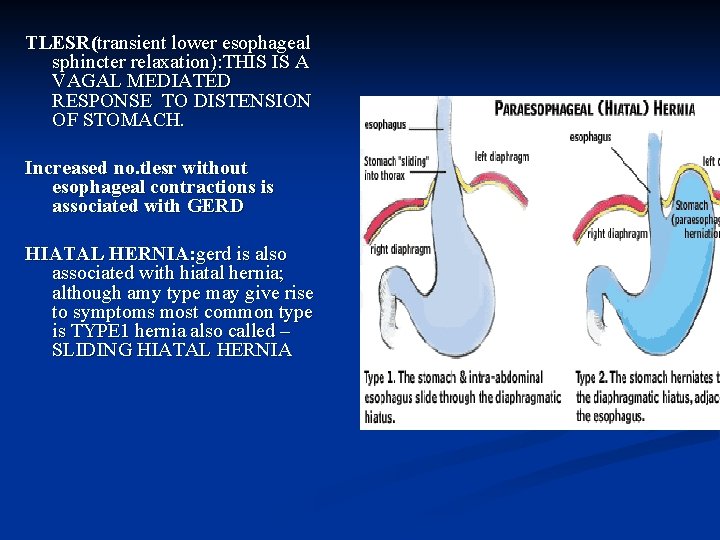 TLESR(transient lower esophageal sphincter relaxation): THIS IS A VAGAL MEDIATED RESPONSE TO DISTENSION OF