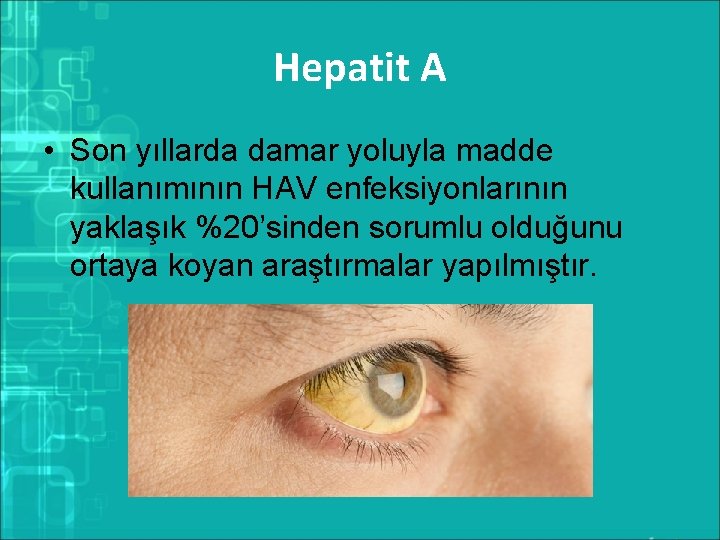 Hepatit A • Son yıllarda damar yoluyla madde kullanımının HAV enfeksiyonlarının yaklaşık %20’sinden sorumlu