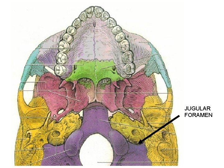 JUGULAR FORAMEN 
