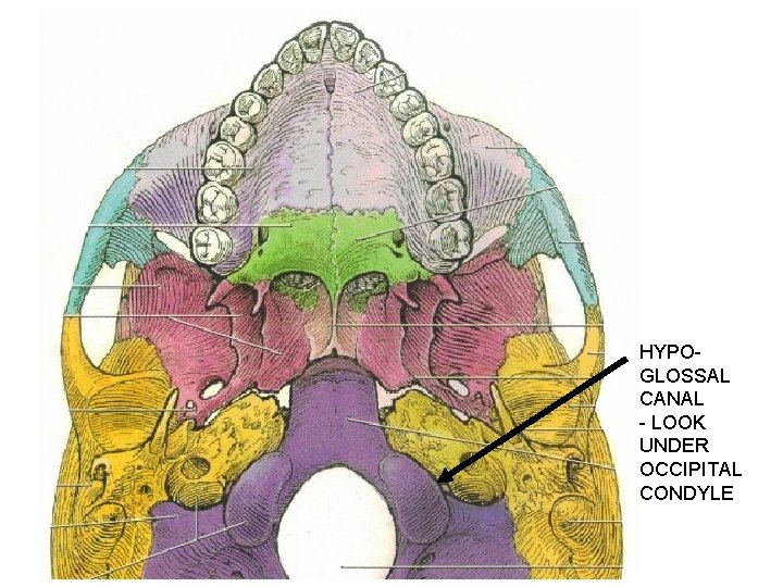 HYPOGLOSSAL CANAL - LOOK UNDER OCCIPITAL CONDYLE 