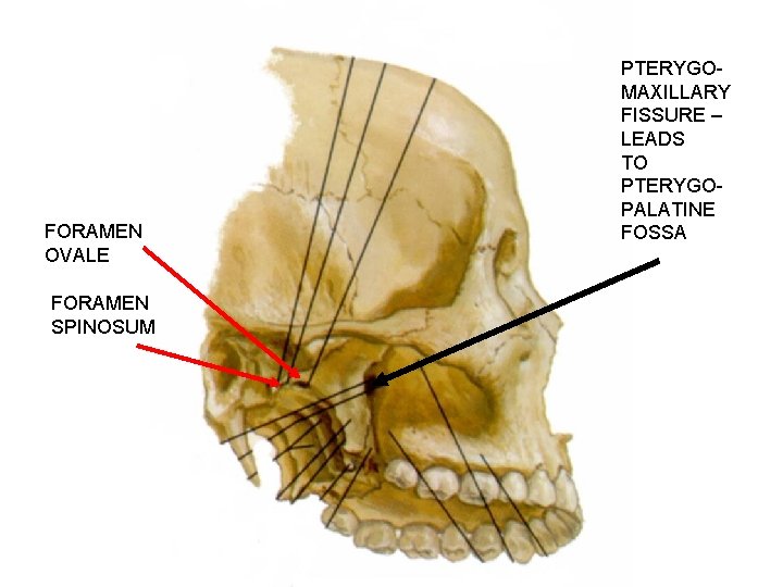 FORAMEN OVALE FORAMEN SPINOSUM PTERYGOMAXILLARY FISSURE – LEADS TO PTERYGOPALATINE FOSSA 