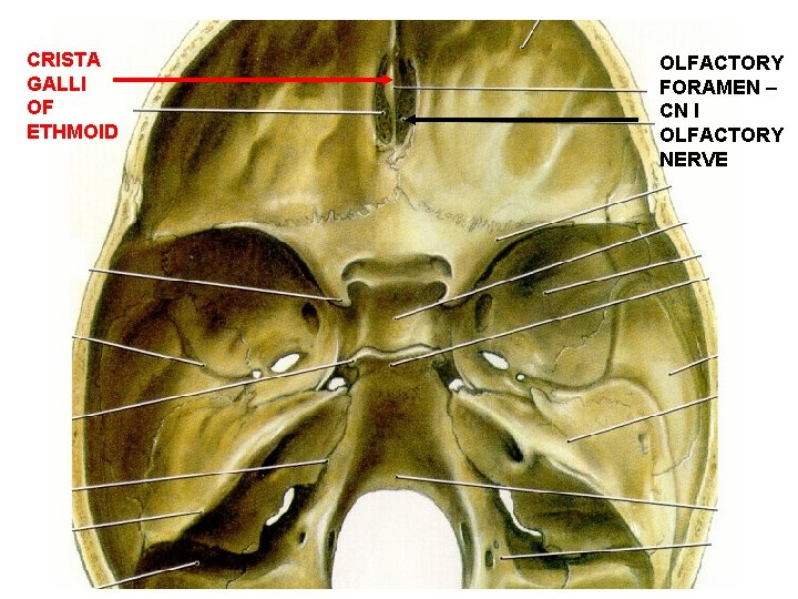 CRISTA GALLI OF ETHMOID OLFACTORY FORAMEN – CN I OLFACTORY NERVE 