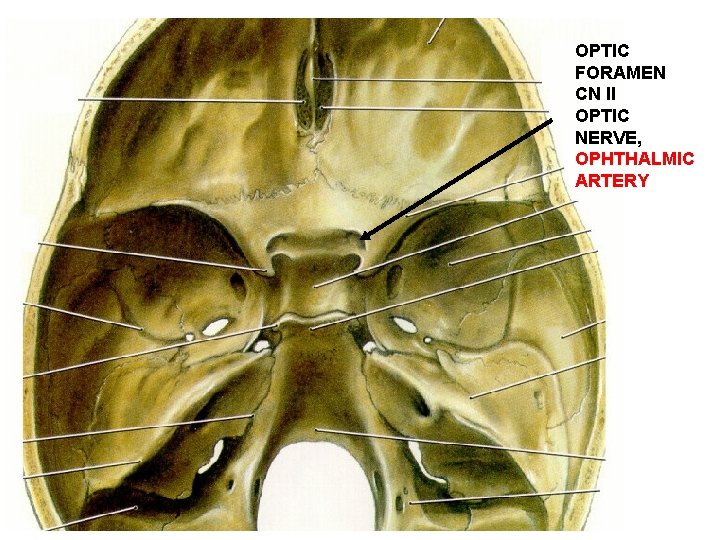 OPTIC FORAMEN CN II OPTIC NERVE, OPHTHALMIC ARTERY 