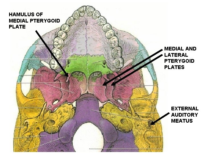 HAMULUS OF MEDIAL PTERYGOID PLATE MEDIAL AND LATERAL PTERYGOID PLATES EXTERNAL AUDITORY MEATUS 