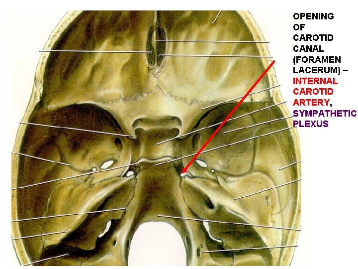 OPENING OF CAROTID CANAL (FORAMEN LACERUM) – INTERNAL CAROTID ARTERY, SYMPATHETIC PLEXUS 