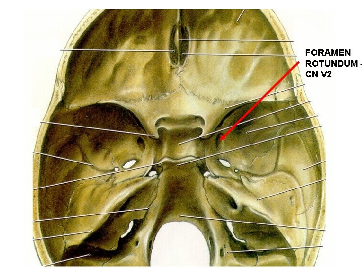 FORAMEN ROTUNDUM – CN V 2 
