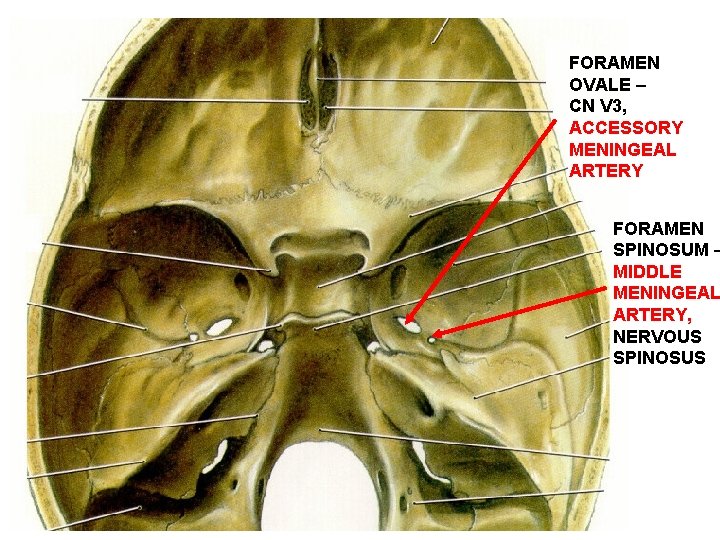 FORAMEN OVALE – CN V 3, ACCESSORY MENINGEAL ARTERY FORAMEN SPINOSUM – MIDDLE MENINGEAL