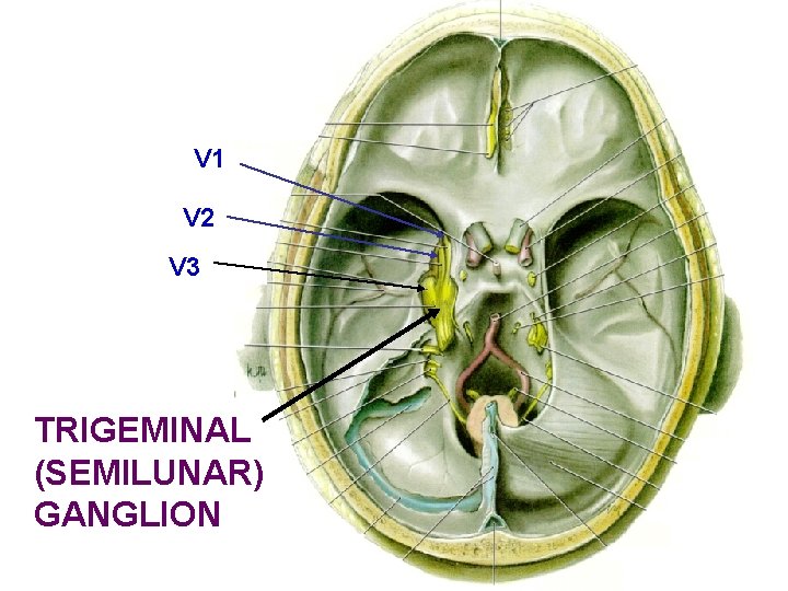 V 1 V 2 V 3 TRIGEMINAL (SEMILUNAR) GANGLION 