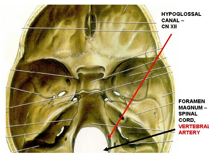 HYPOGLOSSAL CANAL – CN XII FORAMEN MAGNUM – SPINAL CORD, VERTEBRAL ARTERY 