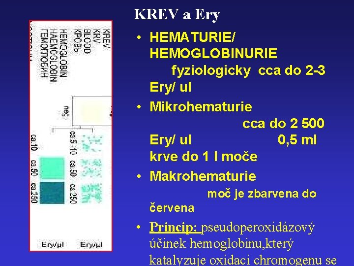 KREV a Ery • HEMATURIE/ HEMOGLOBINURIE fyziologicky cca do 2 -3 Ery/ ul •