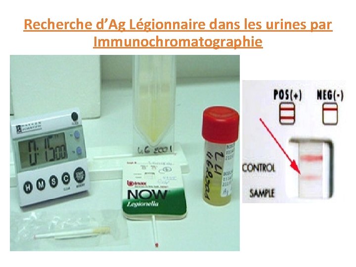 Recherche d’Ag Légionnaire dans les urines par Immunochromatographie 