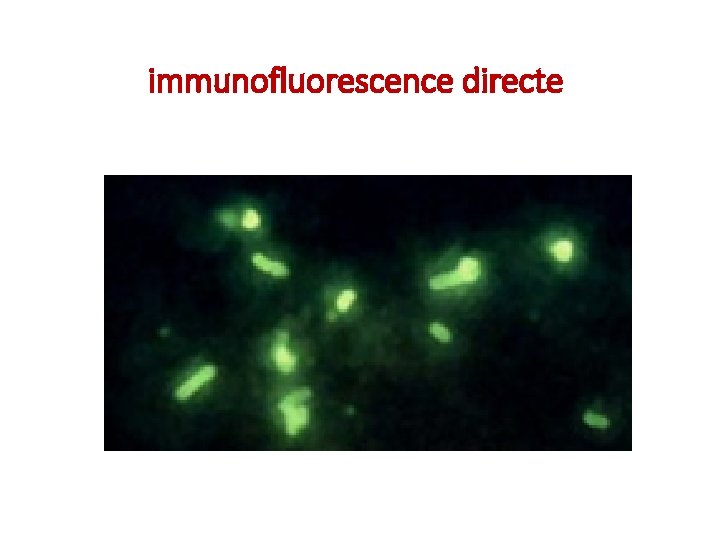 immunofluorescence directe 