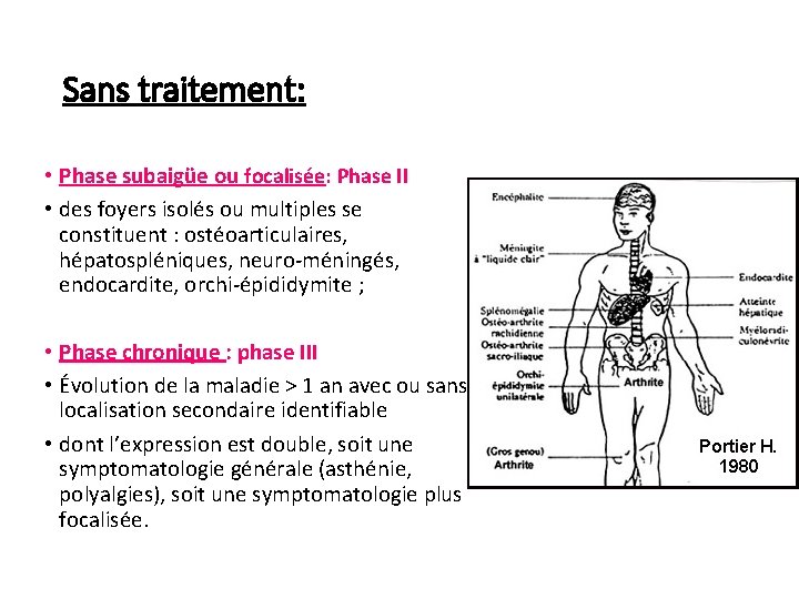 Sans traitement: • Phase subaigüe ou focalisée: Phase II • des foyers isolés ou