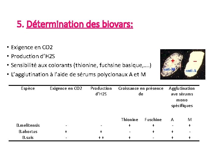 5. Détermination des biovars: • Exigence en CO 2 • Production d’H 2 S