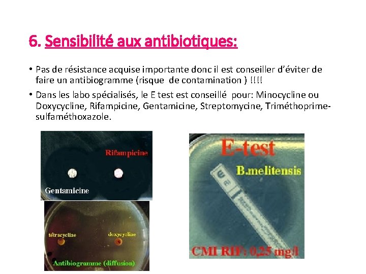 6. Sensibilité aux antibiotiques: • Pas de résistance acquise importante donc il est conseiller