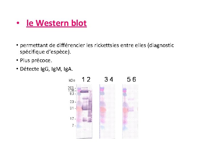  • le Western blot • permettant de différencier les rickettsies entre elles (diagnostic