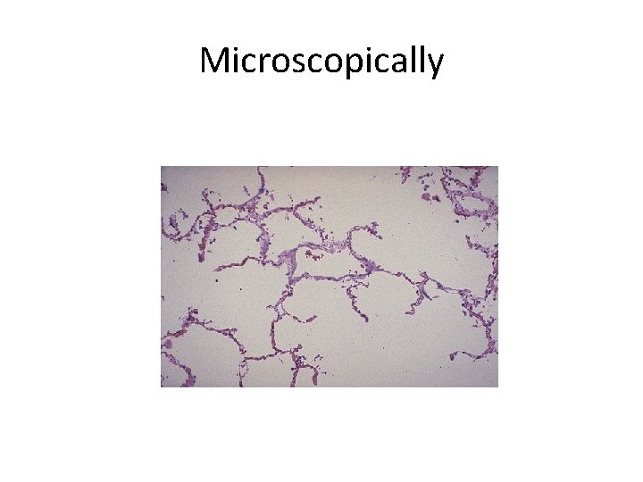 Microscopically 