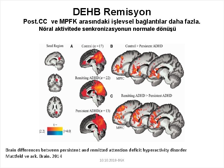 DEHB Remisyon Post. CC ve MPFK arasındaki işlevsel bağlantılar daha fazla. Nöral aktivitede senkronizasyonun