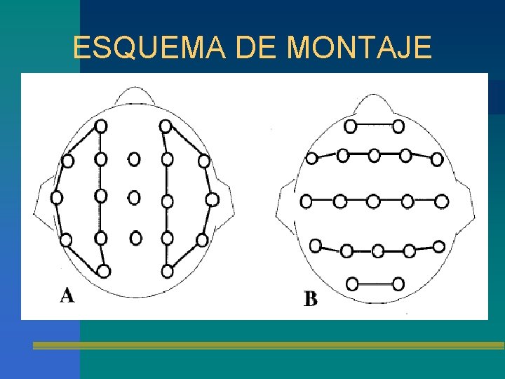 ESQUEMA DE MONTAJE 