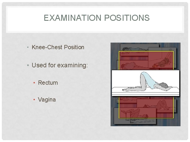 EXAMINATION POSITIONS • Knee-Chest Position • Used for examining: • Rectum • Vagina 