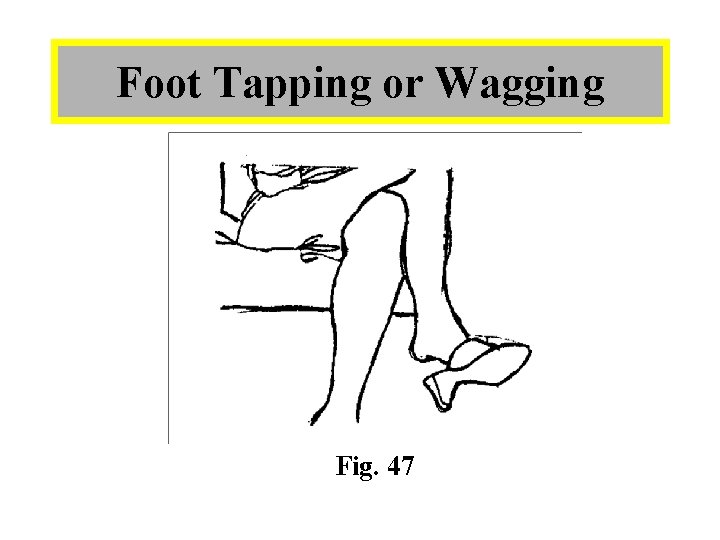 Foot Tapping or Wagging Fig. 47 