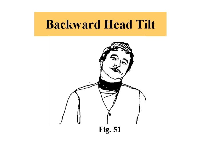 Backward Head Tilt Fig. 51 