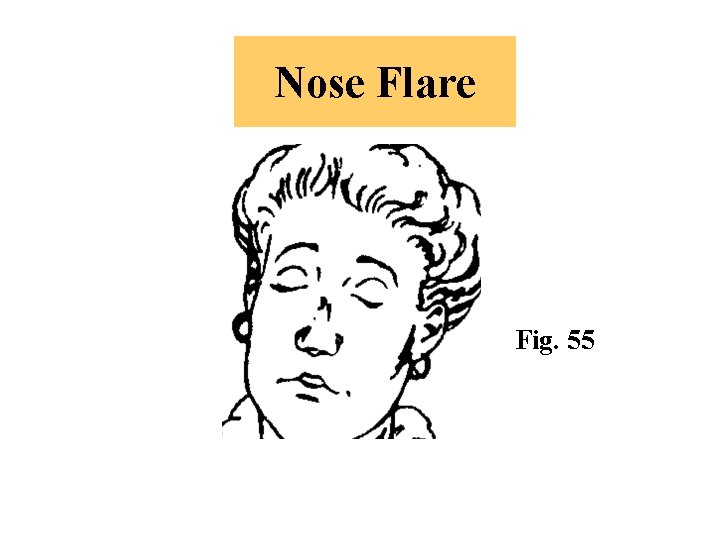 Nose Flare Fig. 55 