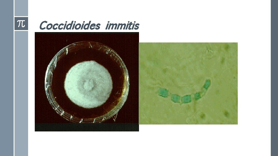 Coccidioides immitis 