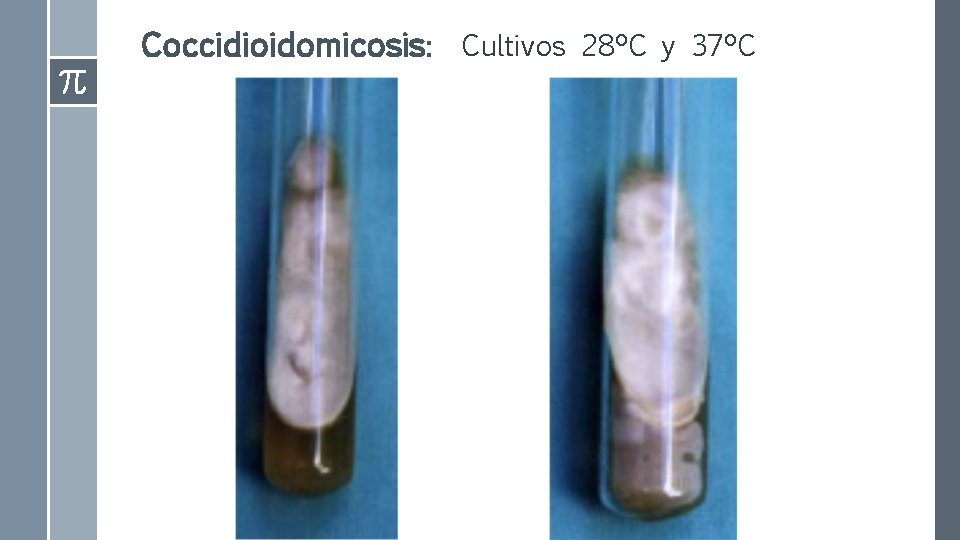 Coccidioidomicosis: Cultivos 28ºC y 37ºC 