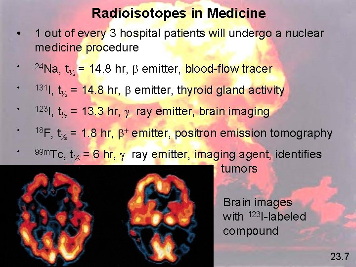 Radioisotopes in Medicine • 1 out of every 3 hospital patients will undergo a