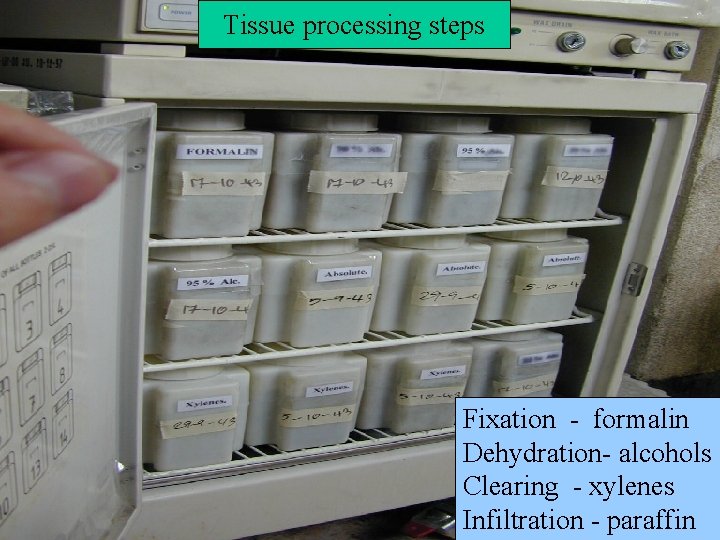 Tissue processing steps Fixation - formalin Dehydration- alcohols Clearing - xylenes Infiltration - paraffin