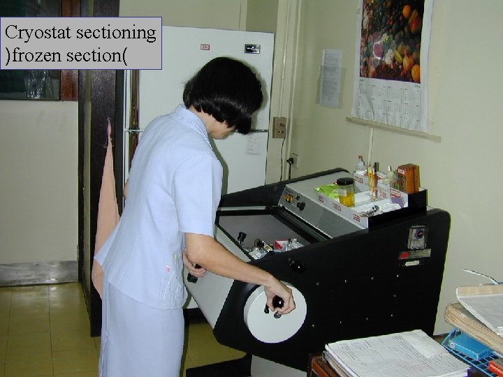 Cryostat sectioning )frozen section( 