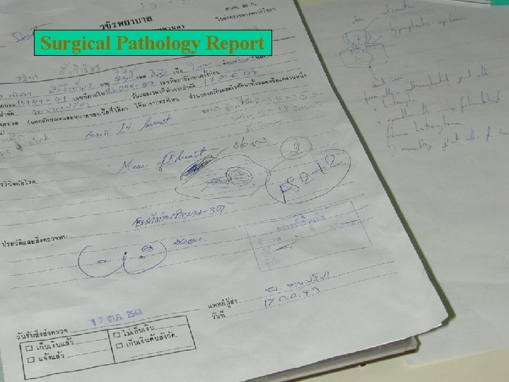 Surgical Pathology Report 