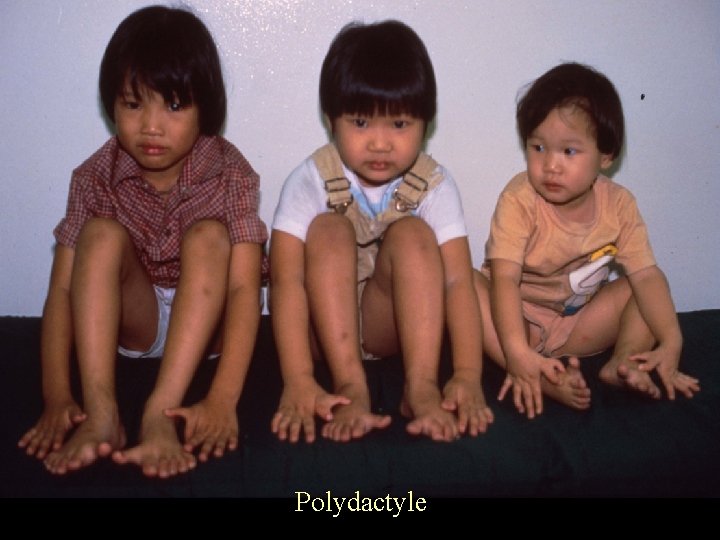 Polydactyle 